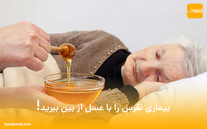 بیماری نقرس را با عسل از بین ببرید!