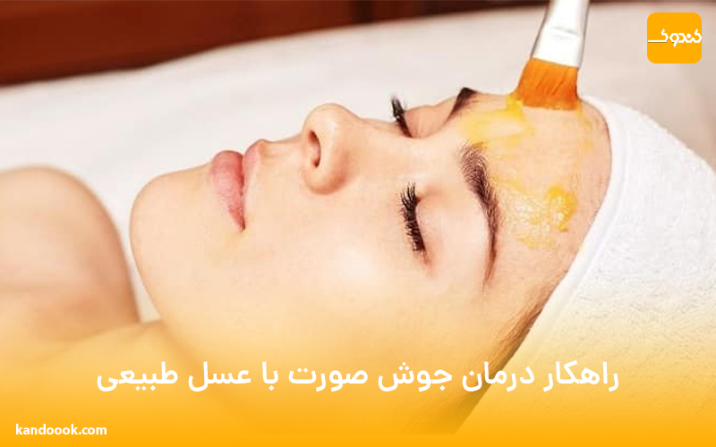 راهکار درمان جوش صورت با عسل طبیعی