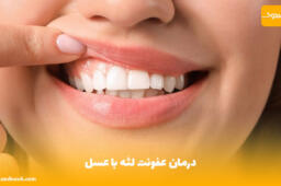 درمان عفونت لثه با عسل