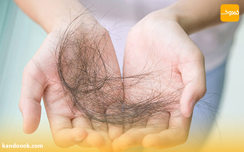  علت ریزش موی شدید و ناگهانی چیست؟