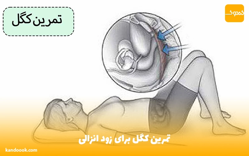 تمرین کگل برای زود انزالی