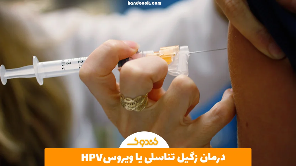 درمان زگیل تناسلی یا ویروس HPV