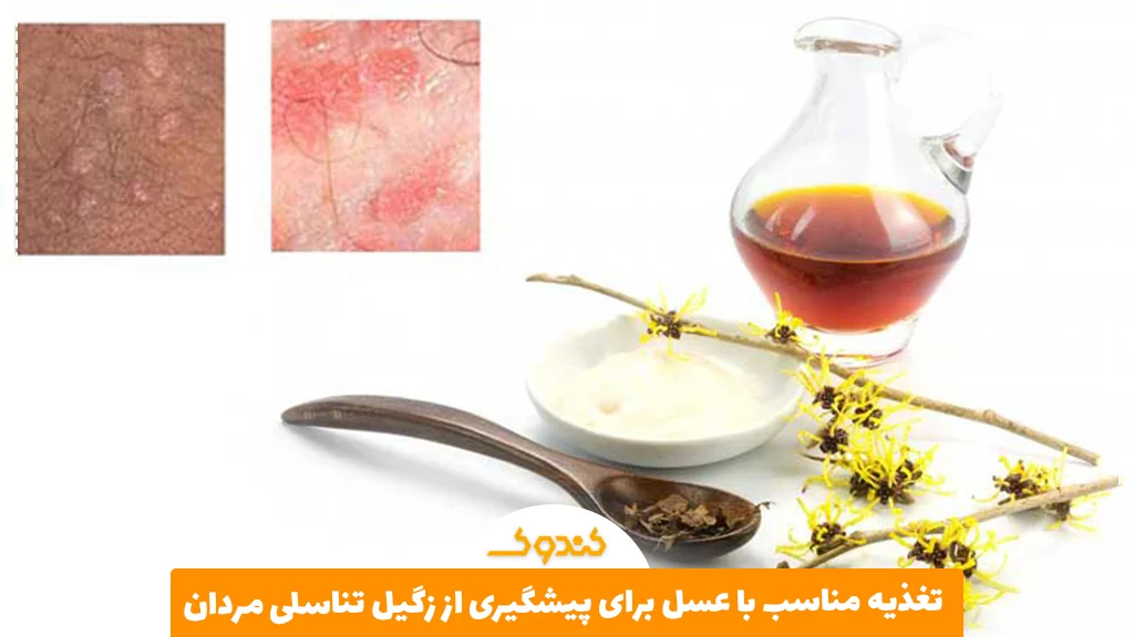 تغذیه مناسب با عسل برای پیشگیری از زگیل تناسلی مردان