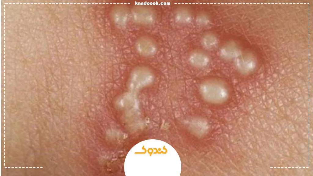موثرترین راه‌ها برای تقویت سیستم ایمنی بدن