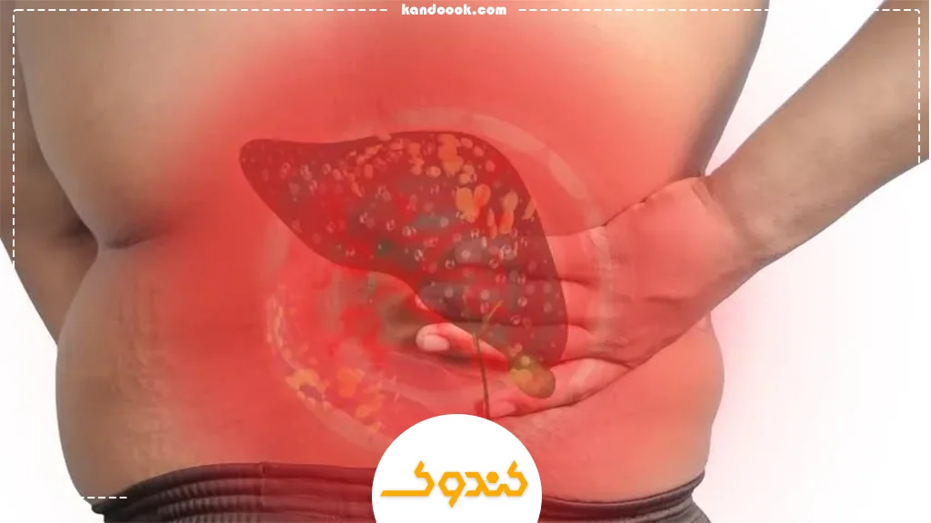 نقش معجون کندوک در بهبود کبد چرب
