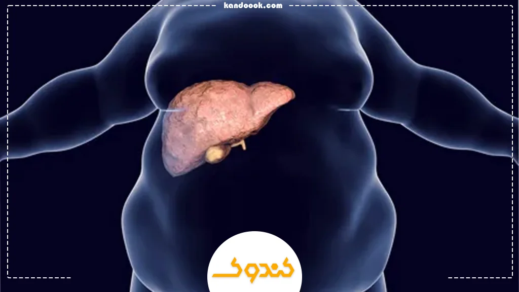 کبد چرب چیست و چرا به آن دچار می‌شویم؟