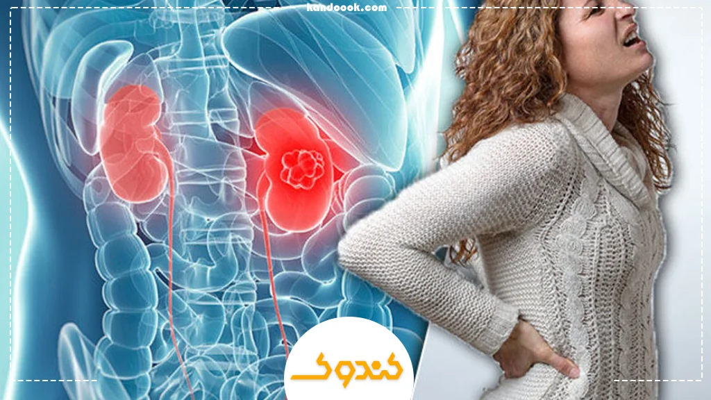 خواص عسل برای کلیه‌ها