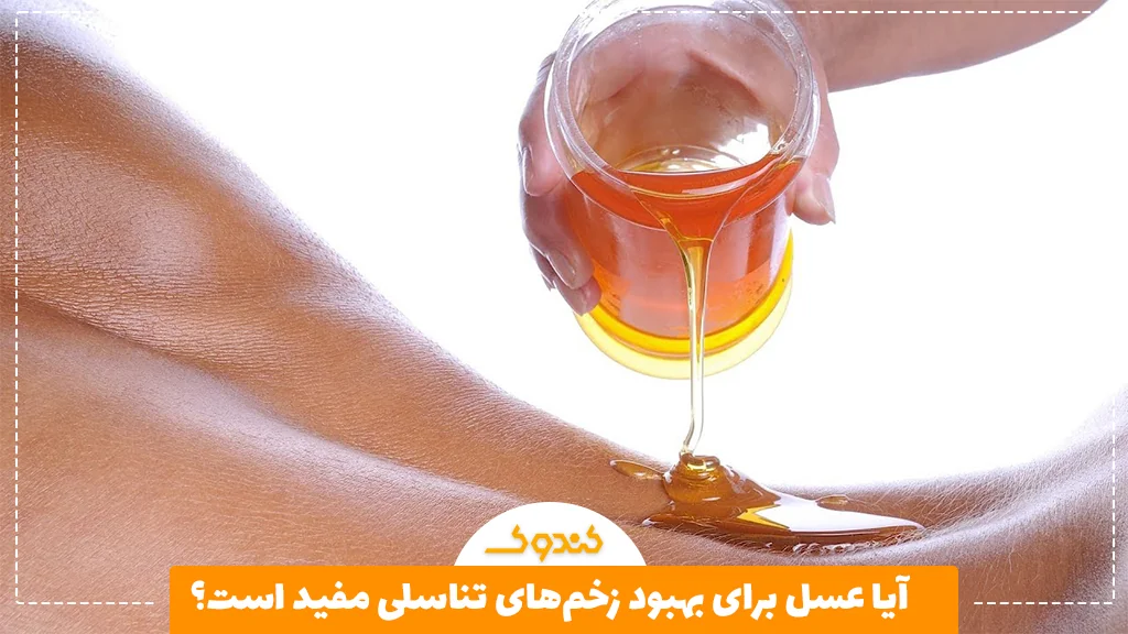 آیا عسل برای بهبود زخم‌های تناسلی مفید است؟