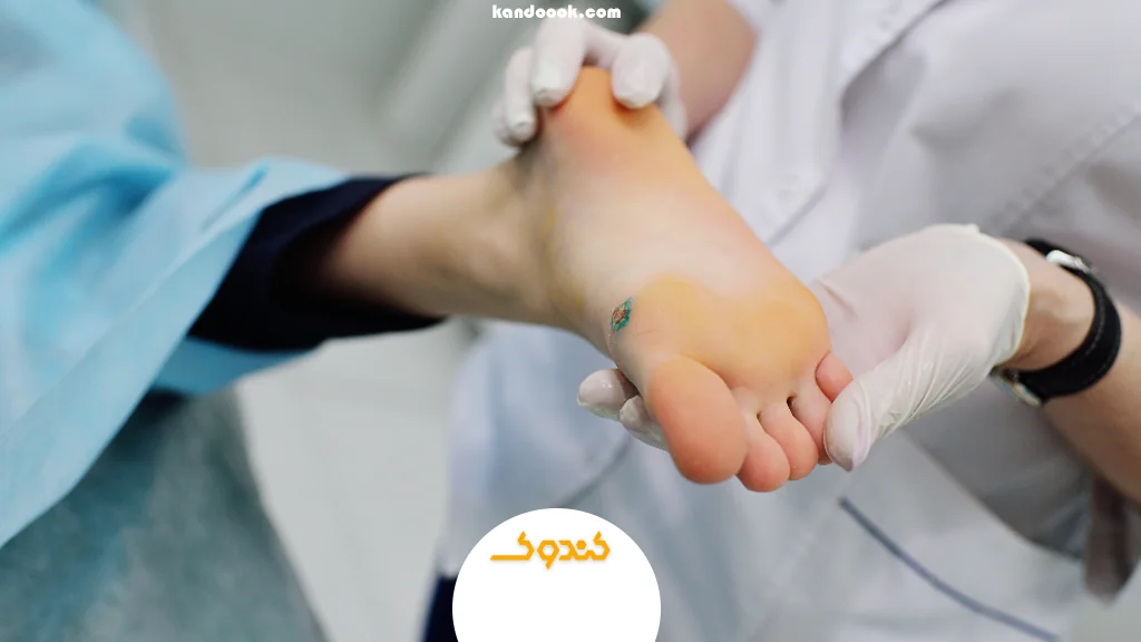 عسل برای ترمیم کدام زخم‌ها مناسب است؟