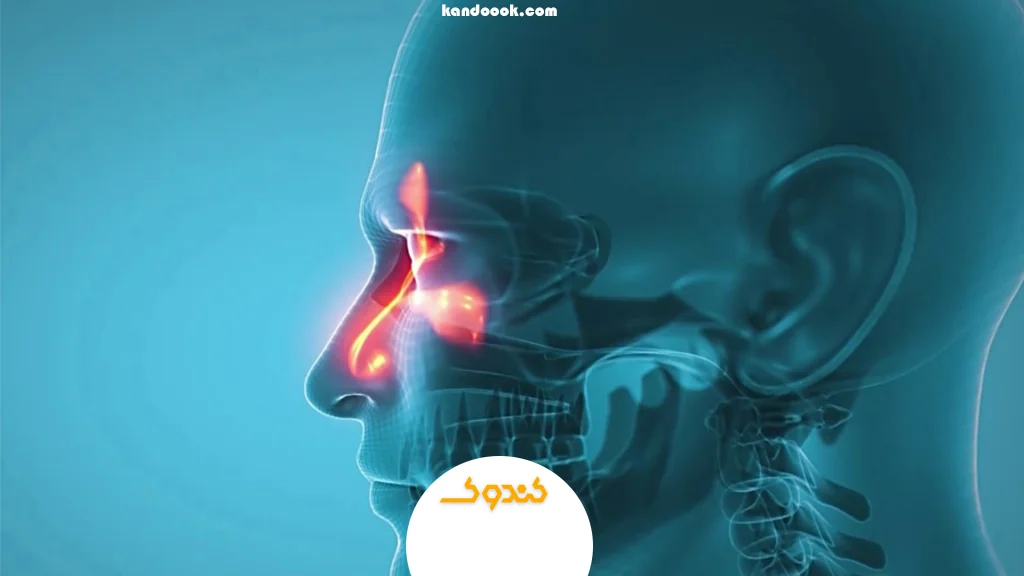 بخور عسل (برای باز کردن سینوس و کاهش التهاب)