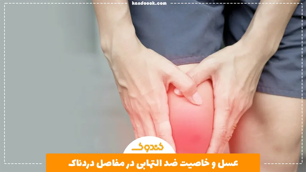 عسل و خاصیت ضد التهابی در مفاصل دردناک