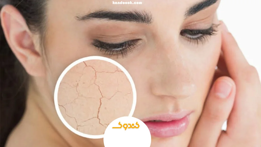 آبرسانی و جلوگیری از خشکی