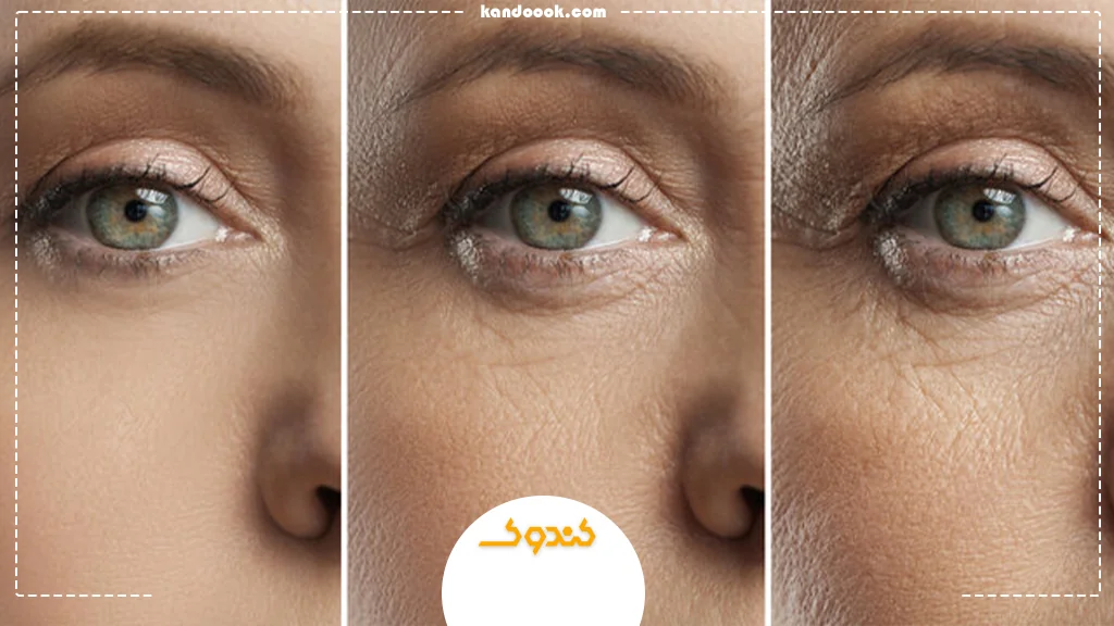 چرا روند پیری در صورت روی میدهد؟