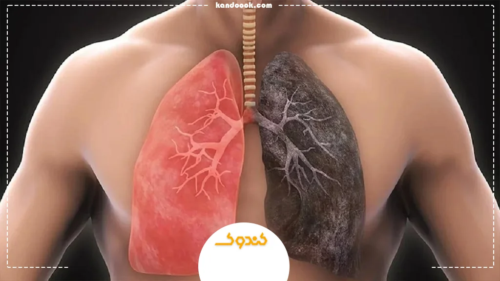 چرا تقویت ریهها مهم است و باید به آن توجه کرد؟