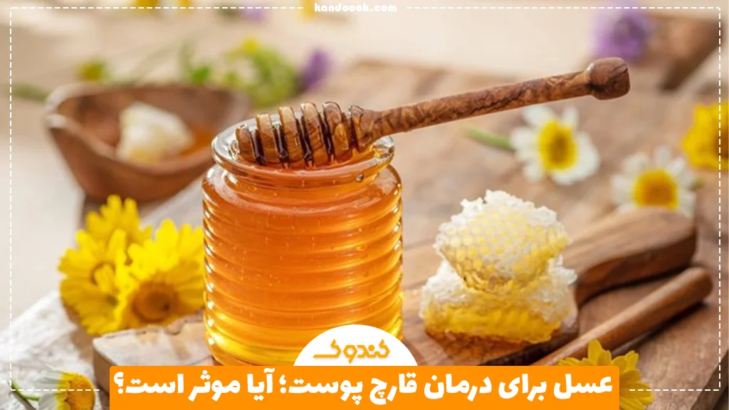 عسل برای درمان قارچ پوست؛ آیا موثر است؟
