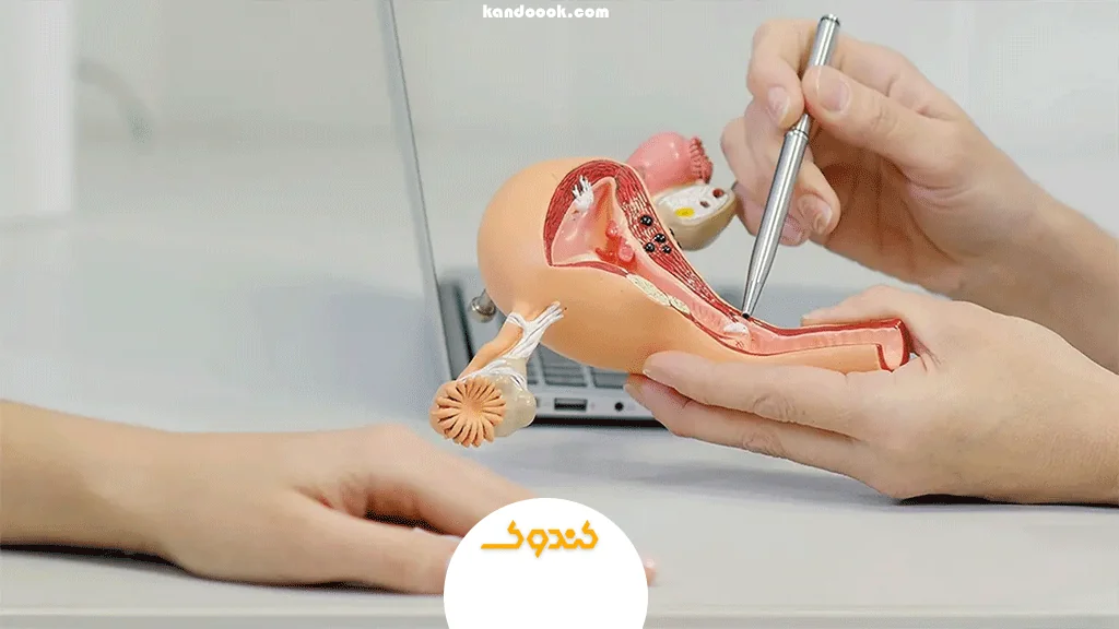 علائم فراوان فیبروم رحم