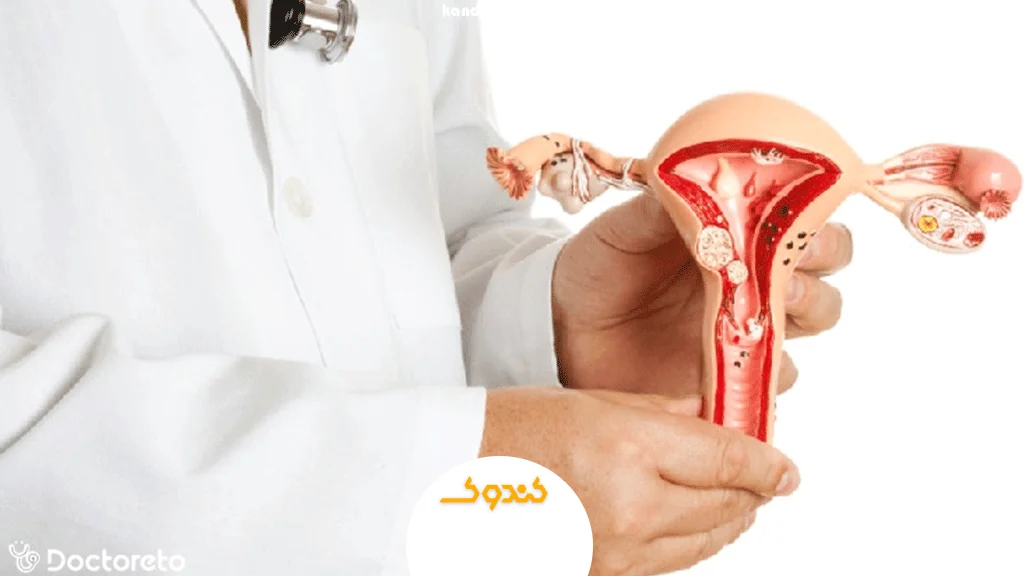 روشهای تشخیص فیبروم