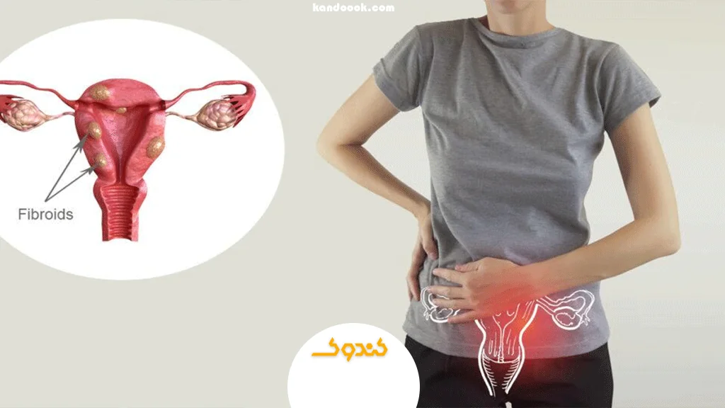 نقش چاقی و فشار خون بالا