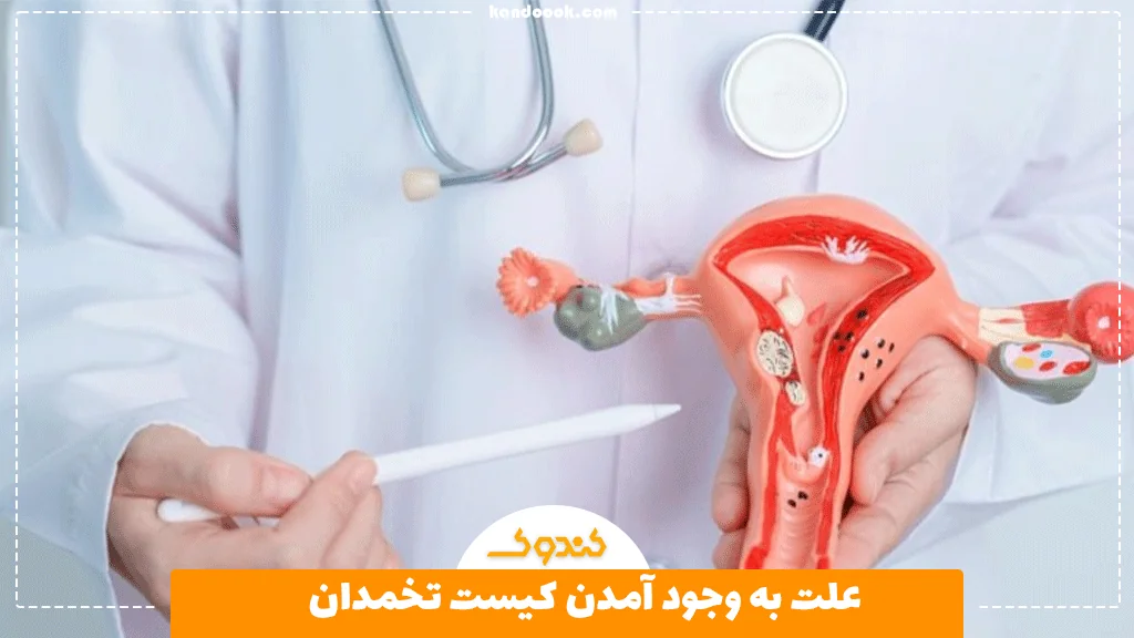 علت به وجود آمدن کیست تخمدان