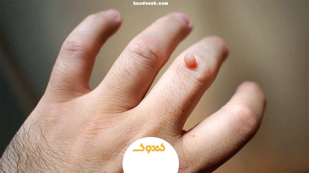 چند وقت طول میکشد تا اثرات آن دیده شود؟